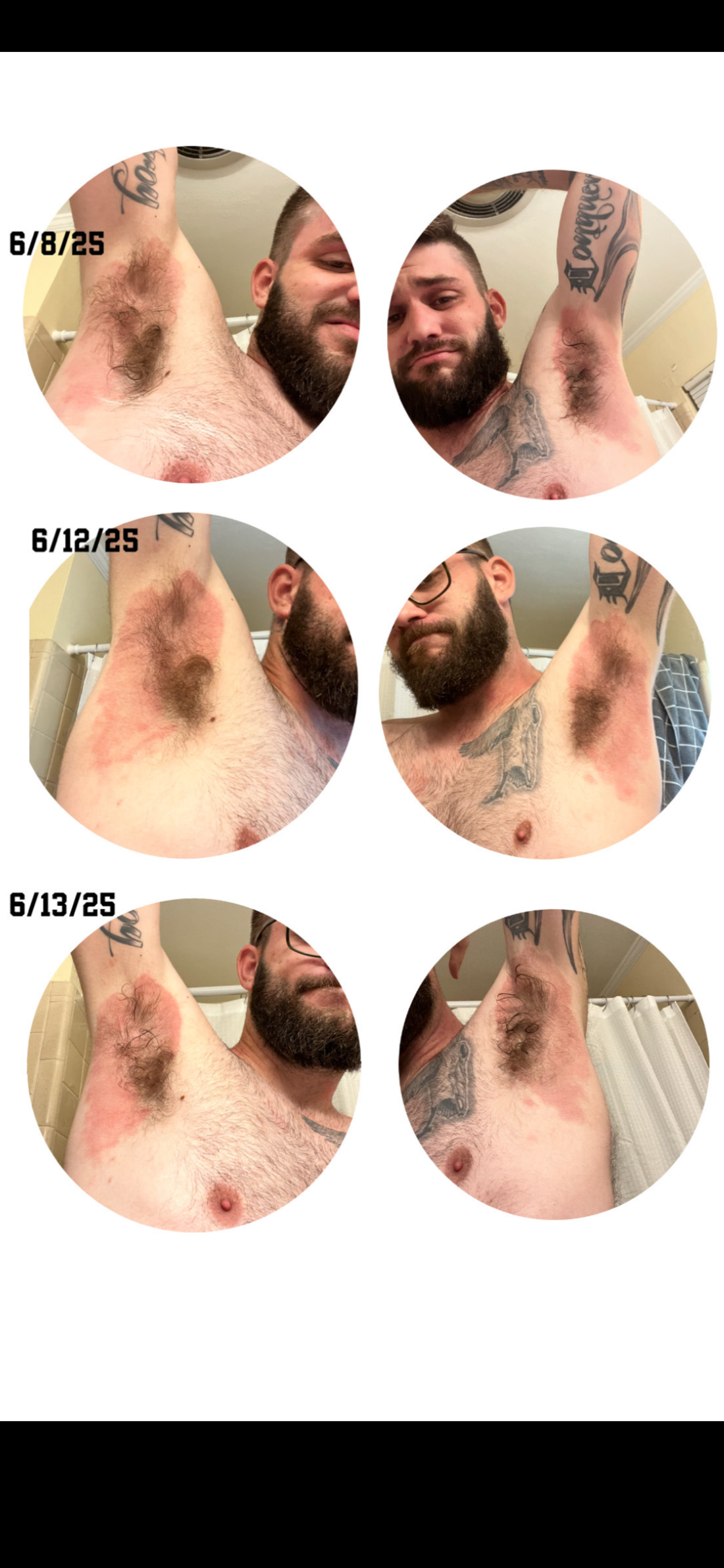 before using cream