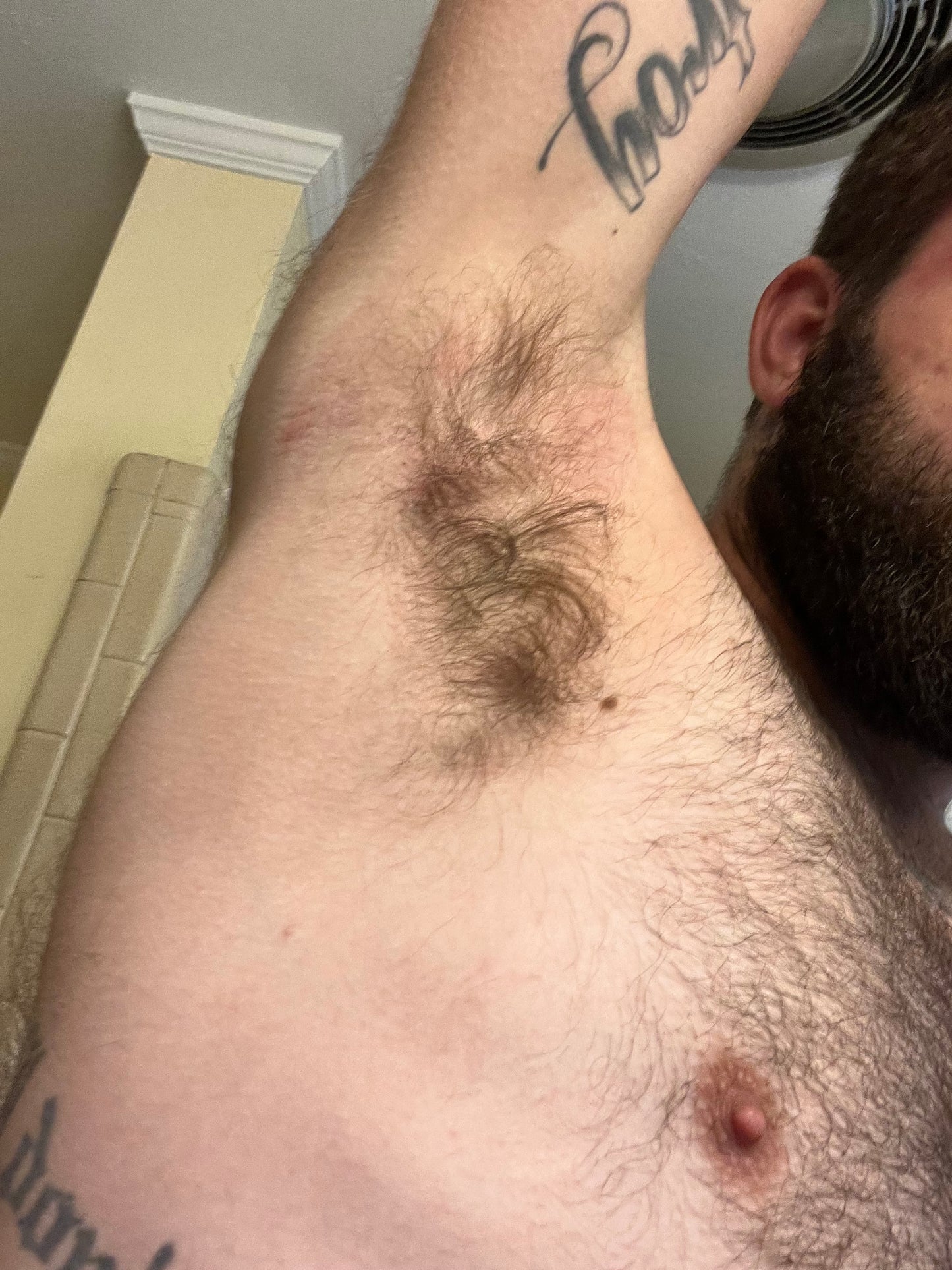 1 month after using cream